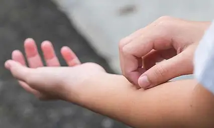 Uzmanlardan Vitamin Eksikliği Uyarısı: Belirtileri Göz Ardı Etmeyin