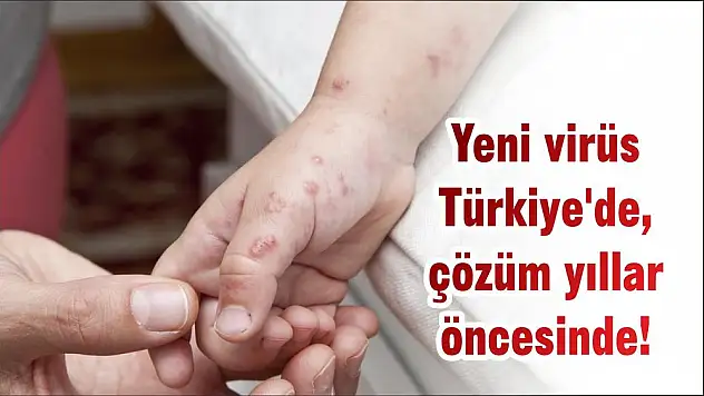 Yeni virüs Türkiye'de, çözüm yıllar öncesinde!