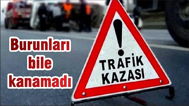 Burunları bile kanamadı