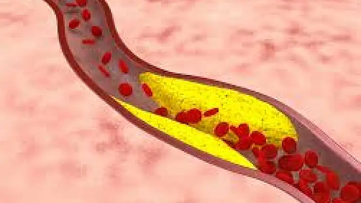 Kalp damar düşmanı besinler