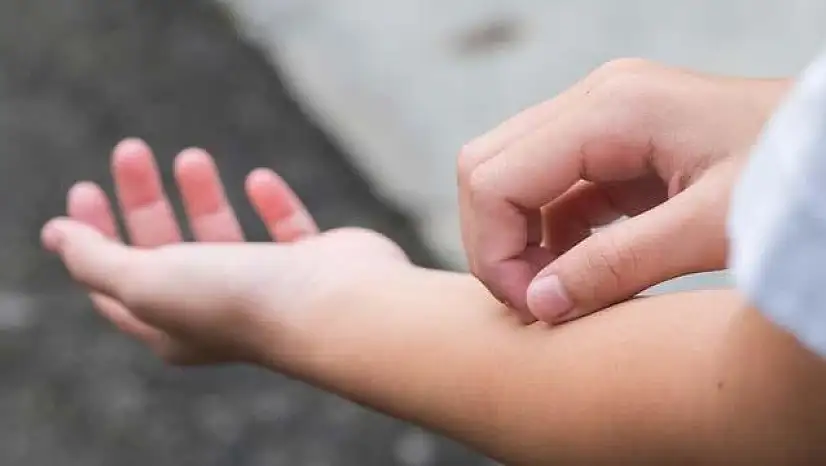 Uzmanlardan Vitamin Eksikliği Uyarısı: Belirtileri Göz Ardı Etmeyin