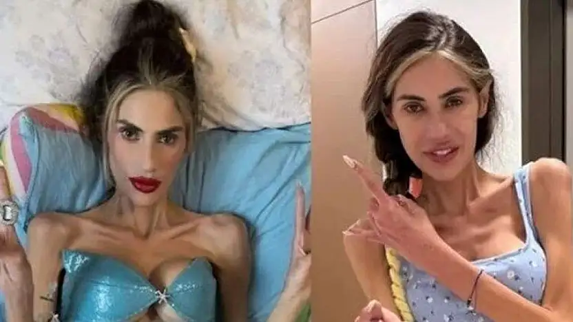 Nihal Candan, Anoreksiya Nervoza Nedeniyle Hayatını Kaybetti